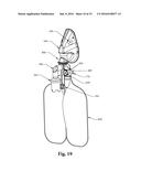 MODULAR PULMONARY TREATMENT SYSTEM diagram and image