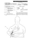 Mechanical Device for Soothing Agitated Patients diagram and image