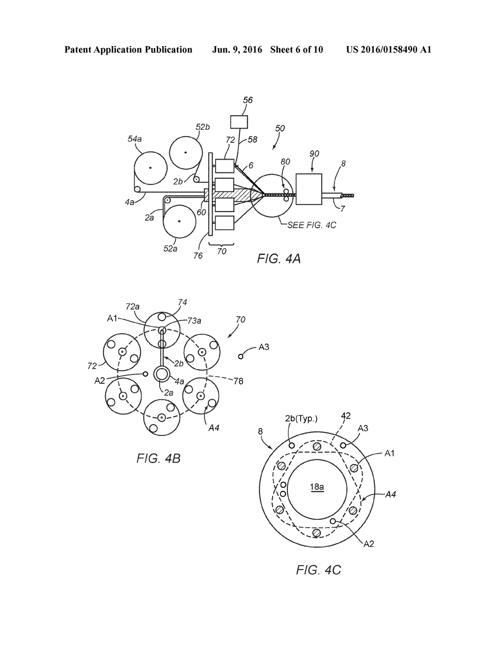 CATHETER DEVICES AND METHODS FOR MAKING THEM - diagram, schematic, and image 07