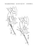 ROBOTIC CATHETER SYSTEM diagram and image