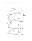 STEERABLE CATHETER WITH PULL WIRE diagram and image