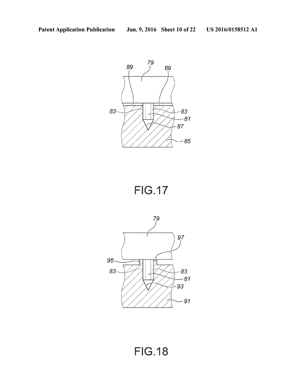 MICRONEEDLE ARRAY AND MICRONEEDLE ARRAY MANUFACTURING METHOD - diagram, schematic, and image 11