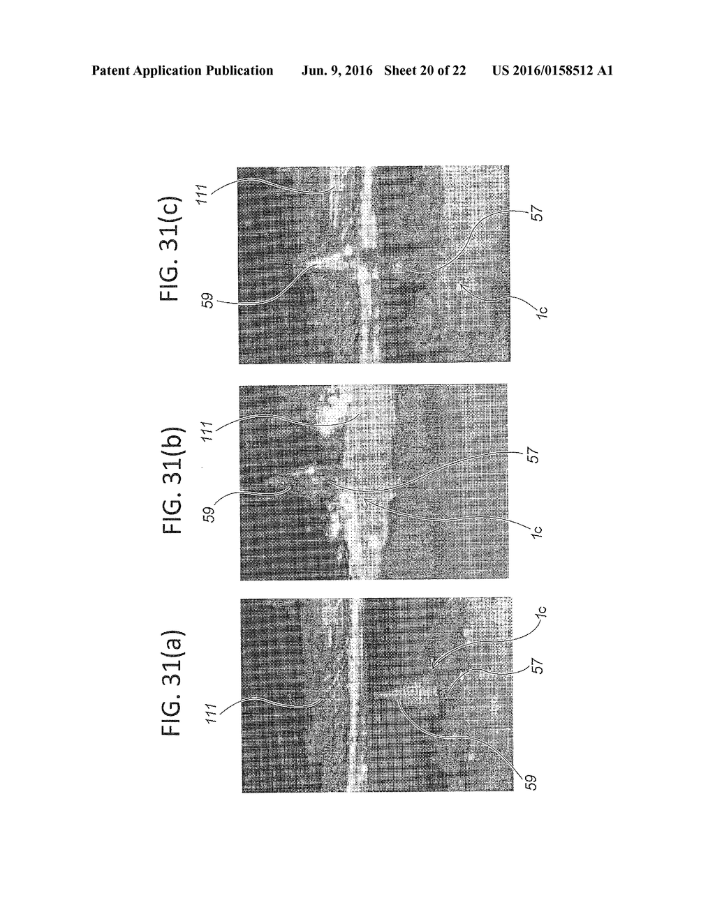 MICRONEEDLE ARRAY AND MICRONEEDLE ARRAY MANUFACTURING METHOD - diagram, schematic, and image 21