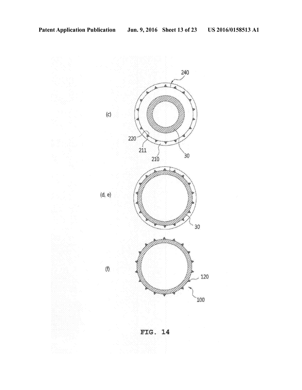 BALLOON CATHETER HAVING MICRO NEEDLES AND MANUFACTURING METHOD FOR THE     SAME - diagram, schematic, and image 14