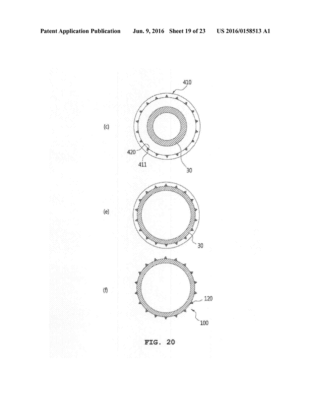 BALLOON CATHETER HAVING MICRO NEEDLES AND MANUFACTURING METHOD FOR THE     SAME - diagram, schematic, and image 20