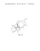 THERAPEUTIC AGENT PREPARATIONS FOR DELIVERY INTO A LUMEN OF THE INTESTINAL     TRACT USING A SWALLOWABLE DRUG DELIVERY DEVICE diagram and image