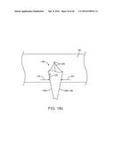 THERAPEUTIC AGENT PREPARATIONS FOR DELIVERY INTO A LUMEN OF THE INTESTINAL     TRACT USING A SWALLOWABLE DRUG DELIVERY DEVICE diagram and image