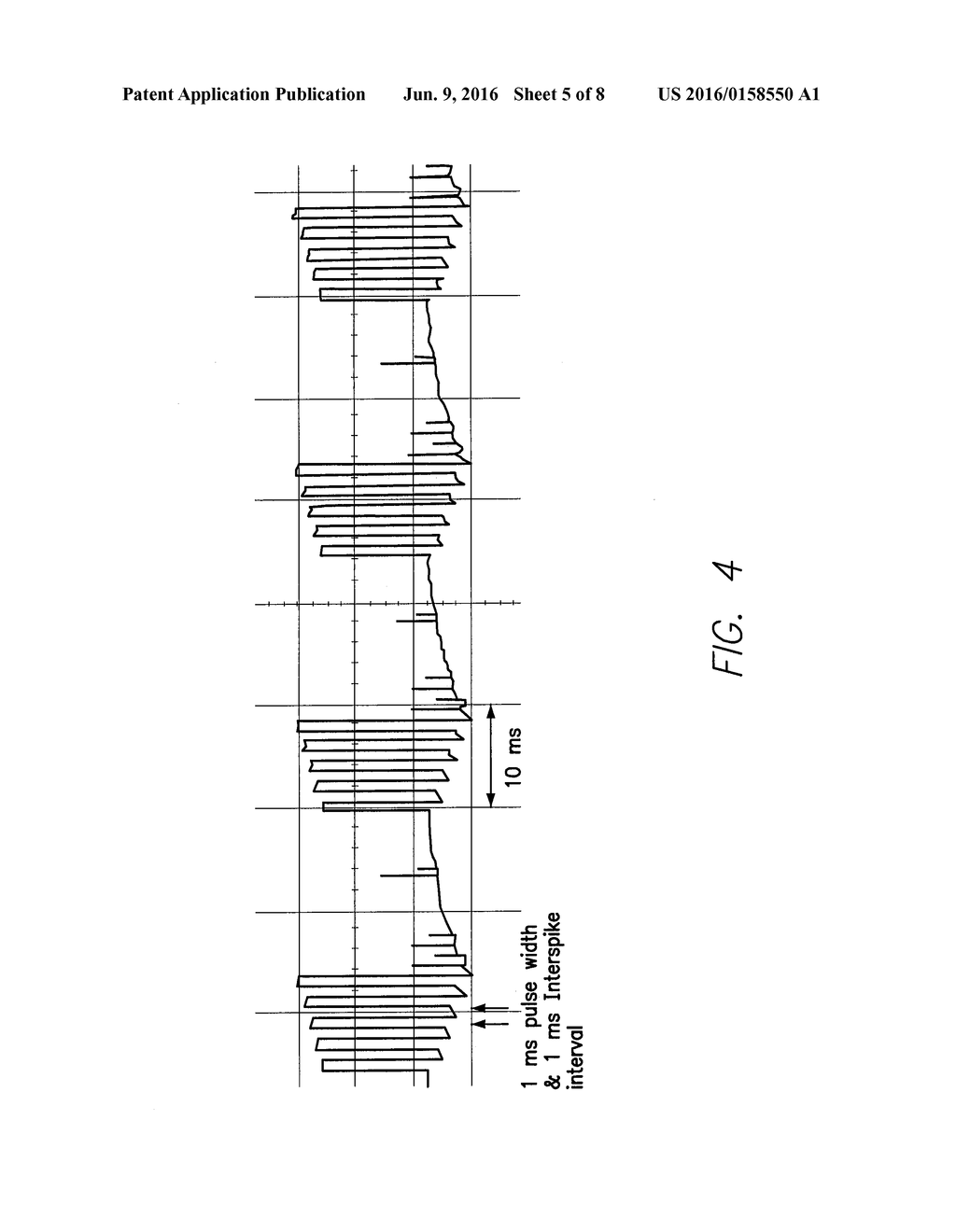 SYSTEM AND METHOD FOR COUPLING BURST AND TONIC STIMULATION - diagram, schematic, and image 06