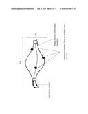 MEDICAL DEVICE FOR RADIOTHERAPY TREATMENT diagram and image