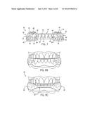 PERFORMANCE ENHANCING BITE REGULATOR AND SELF-IMPRESSION SYSTEM AND METHOD     OF CUSTOM FITTING SAME diagram and image