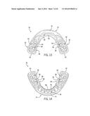 PERFORMANCE ENHANCING BITE REGULATOR AND SELF-IMPRESSION SYSTEM AND METHOD     OF CUSTOM FITTING SAME diagram and image