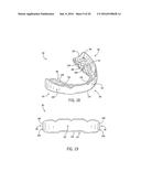 PERFORMANCE ENHANCING BITE REGULATOR AND SELF-IMPRESSION SYSTEM AND METHOD     OF CUSTOM FITTING SAME diagram and image