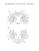 PERFORMANCE ENHANCING BITE REGULATOR AND SELF-IMPRESSION SYSTEM AND METHOD     OF CUSTOM FITTING SAME diagram and image