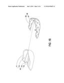 MOUTHGUARD AND FABRICATING METHOD THEREOF diagram and image