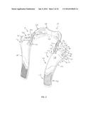 HEAD AND NECK RESTRAINT DEVICE WITH DYNAMIC ARTICULATION diagram and image