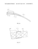 HEAD AND NECK RESTRAINT DEVICE WITH DYNAMIC ARTICULATION diagram and image