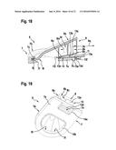 DRAINAGE END CAP DEVICE FOR DRAINING FLUID FROM A HOLLOW SPACE IN A     VEHICLE diagram and image