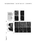 METHODS AND COMPOSITIONS FOR TREATING CANCER AND INFLAMMATORY DISEASES diagram and image