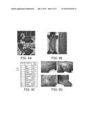 HETEROZYGOUS MODIFICATIONS OF TUMOR SUPPRESSOR GENES diagram and image