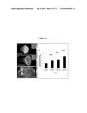 PERSONALIZED PROTEASE ASSAY TO MEASURE PROTEASE ACTIVITY IN NEOPLASMS diagram and image