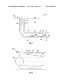 DEGRADABLE ANCHOR DEVICE WITH INSERTS diagram and image