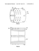 DEGRADABLE ANCHOR DEVICE WITH INSERTS diagram and image