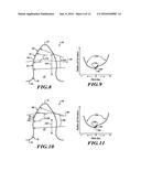 CONTROLLED RELATIVE RADIUS OF CURVATURE FORGED BEVEL GEARS WITH INVOLUTE     SECTION diagram and image