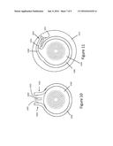 SYSTEMS AND METHODS FOR APPLYING METALLIC LAMINATES TO CABLES diagram and image