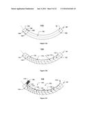 Method of Reducing Multipole Content In A Conductor Assembly During     Manufacture diagram and image