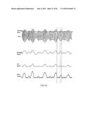 Amplifier Dynamic Bias Adjustment for Envelope Tracking diagram and image