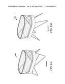 INFANT CALMING/SLEEP-AID, SIDS PREVENTION DEVICE, AND METHOD OF USE diagram and image