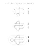 INFANT CALMING/SLEEP-AID, SIDS PREVENTION DEVICE, AND METHOD OF USE diagram and image