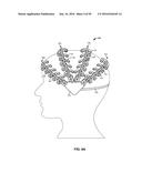 SYSTEMS AND METHODS TO GATHER AND ANALYZE ELECTROENCEPHALOGRAPHIC DATA diagram and image