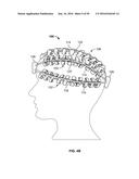 SYSTEMS AND METHODS TO GATHER AND ANALYZE ELECTROENCEPHALOGRAPHIC DATA diagram and image