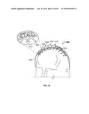 SYSTEMS AND METHODS TO GATHER AND ANALYZE ELECTROENCEPHALOGRAPHIC DATA diagram and image