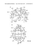 SYSTEMS AND METHODS TO GATHER AND ANALYZE ELECTROENCEPHALOGRAPHIC DATA diagram and image