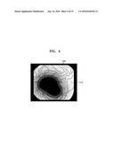 ULTRASOUND DIAGNOSTIC APPARATUS AND METHOD OF OPERATING THE SAME diagram and image