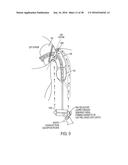 METHODS AND SYSTEMS FOR PREVENTING BLEEDING FROM THE LEFT ATRIAL APPENDAGE diagram and image