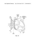 METHODS AND SYSTEMS FOR PREVENTING BLEEDING FROM THE LEFT ATRIAL APPENDAGE diagram and image