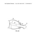 METHODS AND SYSTEMS FOR PREVENTING BLEEDING FROM THE LEFT ATRIAL APPENDAGE diagram and image