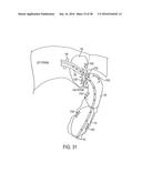 METHODS AND SYSTEMS FOR PREVENTING BLEEDING FROM THE LEFT ATRIAL APPENDAGE diagram and image