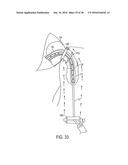 METHODS AND SYSTEMS FOR PREVENTING BLEEDING FROM THE LEFT ATRIAL APPENDAGE diagram and image