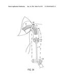 METHODS AND SYSTEMS FOR PREVENTING BLEEDING FROM THE LEFT ATRIAL APPENDAGE diagram and image