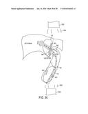 METHODS AND SYSTEMS FOR PREVENTING BLEEDING FROM THE LEFT ATRIAL APPENDAGE diagram and image