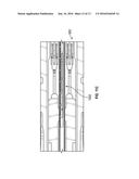 STAPLING DEVICE WITH DISTALLY LOCATED HYDRAULIC DRIVE- RECIPROCALLY     OPERATED SYSTEM AND METHOD diagram and image