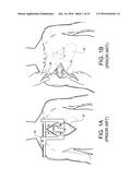 SURGICAL RIB CUTTER AND METHODS THEREOF diagram and image