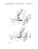 SURGICAL RIB CUTTER AND METHODS THEREOF diagram and image