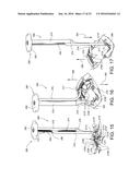 SURGICAL RIB CUTTER AND METHODS THEREOF diagram and image