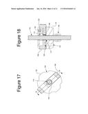 INSTRUMENT FOR FRACTURE FRAGMENT ALIGNMENT AND STABILIZATION diagram and image