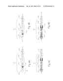 Methods and Devices for Removal of Thromboembolic Material diagram and image